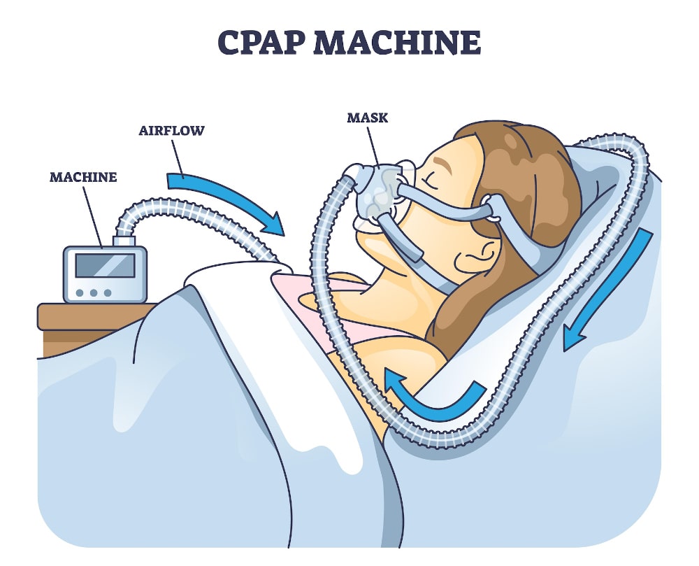 What is a CPAP Machine for Sleeping?